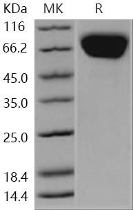 Human FLRT3 Recombinant Protein (His Tag) (Active) (RPES1837)