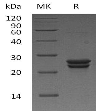 Human CDO1 Recombinant Protein (RPES1839)