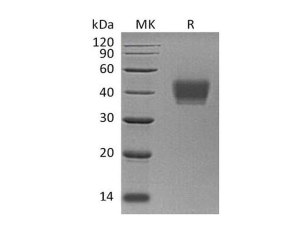 Human KIR2DL3 Recombinant Protein (RPES1848)