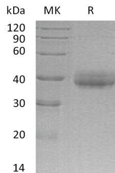 Human CRELD2 Recombinant Protein (RPES1878)