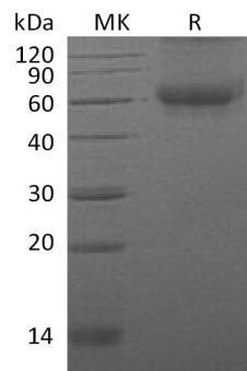 Mouse DDR1 Kinase/MCK10 Recombinant Protein (His &GST Tag) (Active) (RPES1894)