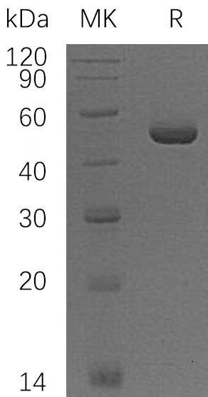 Human PMM1 Recombinant Protein (RPES1900)