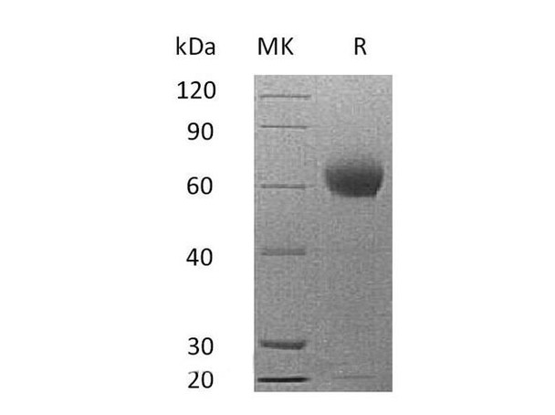 Mouse Complement Factor H Recombinant Protein (RPES1909)