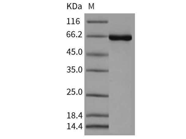 Mouse CSNK2A1/CK2A1 Recombinant Protein (His & GST Tag) (Active) (RPES1915)