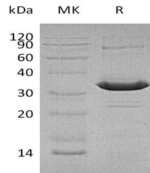 Human ATF1 Recombinant Protein (RPES1918)