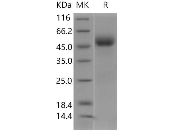Human IL1R2/CD121b Recombinant Protein (Active) (RPES1934)