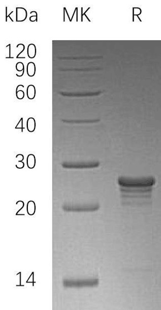 PMVK Recombinant Protein (RPES1941)