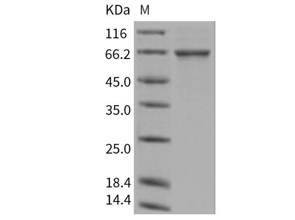 Human TGFBI/BIGH3 Recombinant Protein (His Tag) (RPES1953)