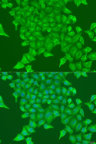 Anti-BST2 Antibody (CAB1914)