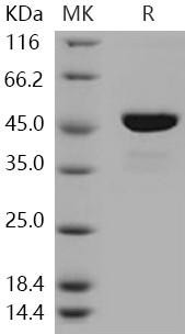 Human SOCS3/CIS3 Recombinant Protein (His & Trx Tag) (RPES1992)