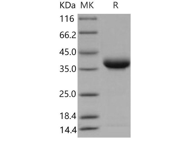 Mouse JAM2/CD322 Recombinant Protein (His Tag) (Active) (RPES1996)