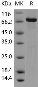 Human DDR2 Kinase/CD167b Recombinant Protein (aa 422-855, His & GST Tag) (Active) (RPES2011)