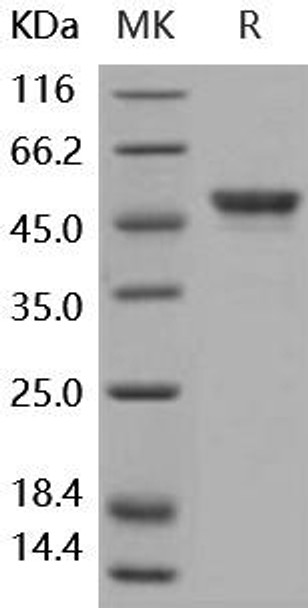 Carbonic Anhydrase 9/CA9 Recombinant Protein (RPES2015)