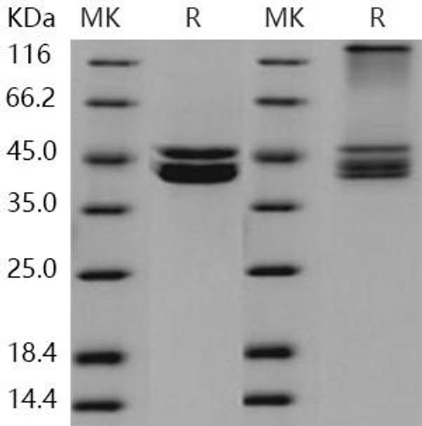 Human PRMT6/HRMT1L6 Recombinant Protein (His & FLAG Tag) (RPES2034)