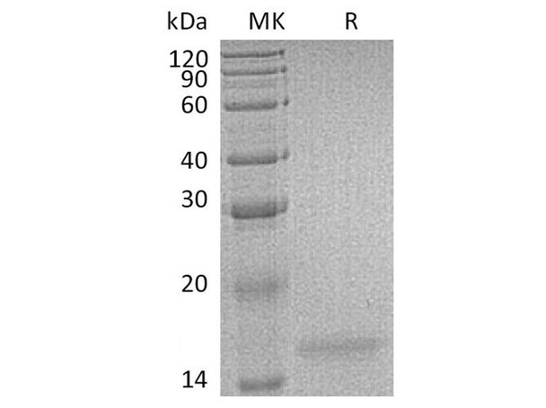 Human Interleukin7F/IL7F Recombinant Protein (Active) (RPES2042)