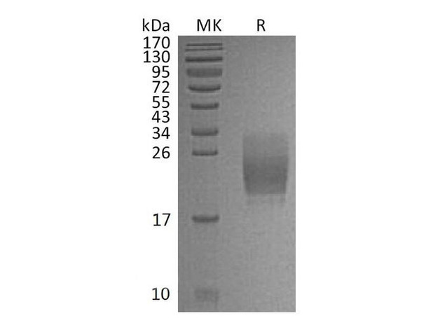 Mouse CD160/BY55 Recombinant Protein (RPES2051)