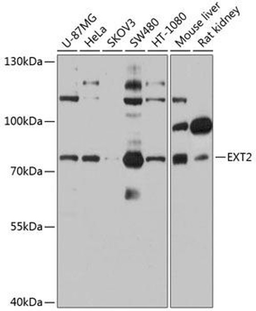 Anti-EXT2 Antibody (CAB1973)