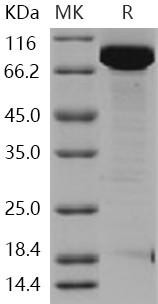 Human EED/Embryonic Ectoderm Development Recombinant Protein (His & GST Tag) (RPES2074)