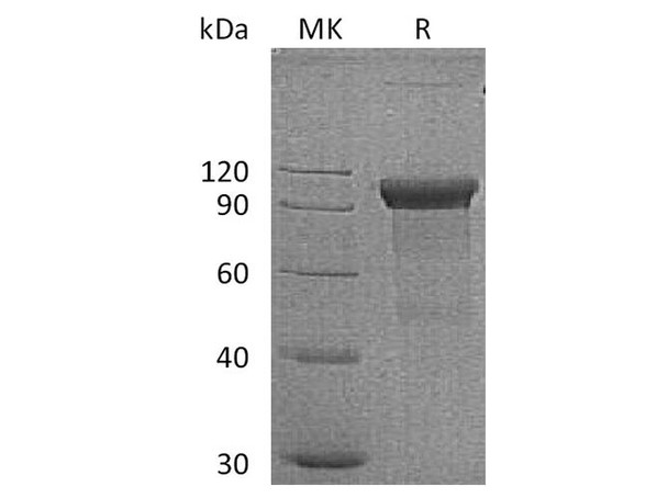 Human ROR1 Recombinant Protein (RPES2091)