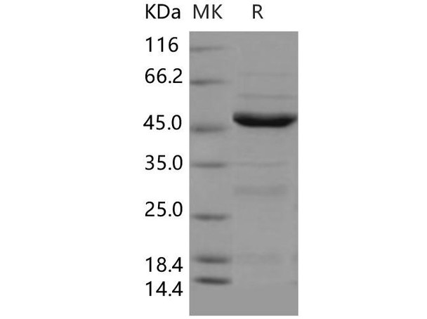 Human NEIL1 Recombinant Protein (His Tag) (RPES2094)