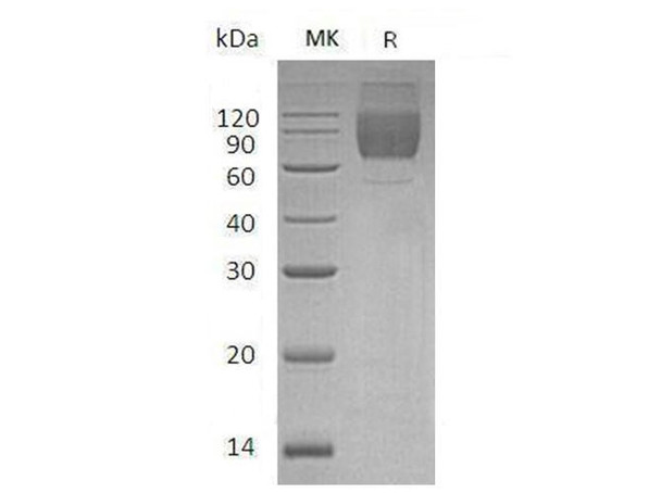 Mouse CD86/B7-2 Recombinant Protein (RPES2113)
