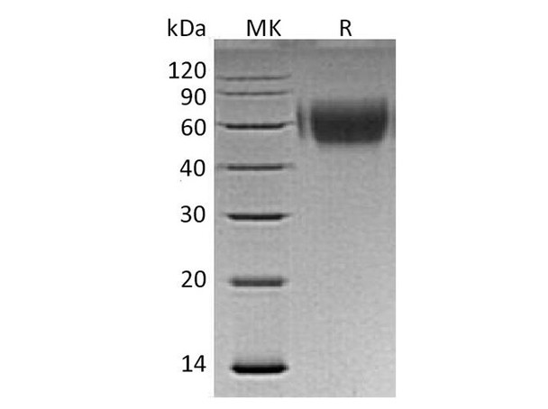 Human MICA Recombinant Protein (RPES2133)