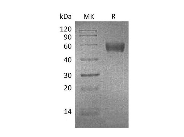 Mouse Apolipoprotein H/ApoH Recombinant Protein (RPES2156)