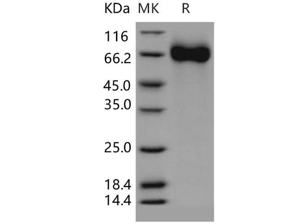 Human CHST15/BRAG Recombinant Protein (His Tag) (RPES2164)