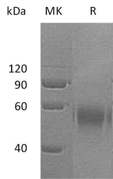 Human DR6/TNFRSF21 Recombinant Protein (RPES2166)