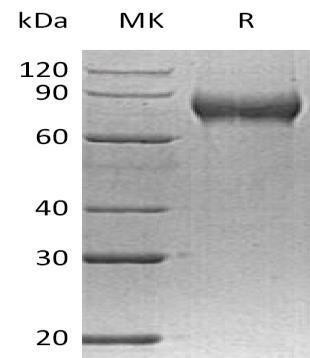 Human FLRT2 Recombinant Protein (His Tag) (Active) (RPES2180)