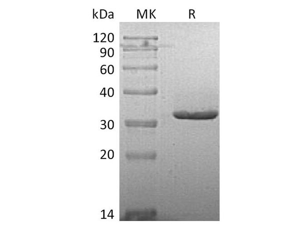 Human IgG2-Fc Recombinant Protein (RPES2197)