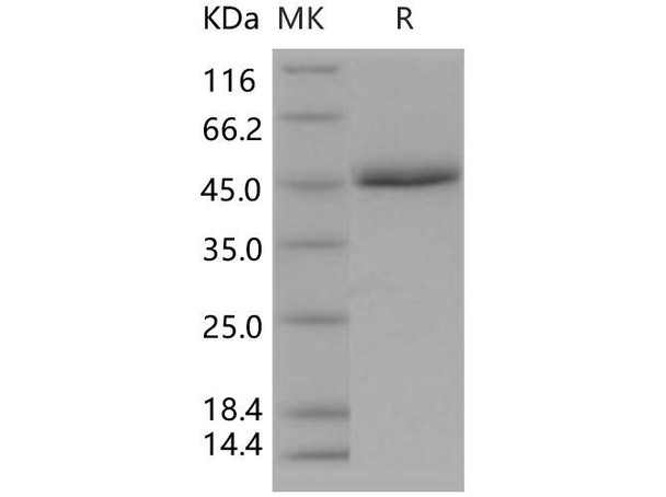 Human CD5 Recombinant Protein (His Tag) (Active) (RPES2206)