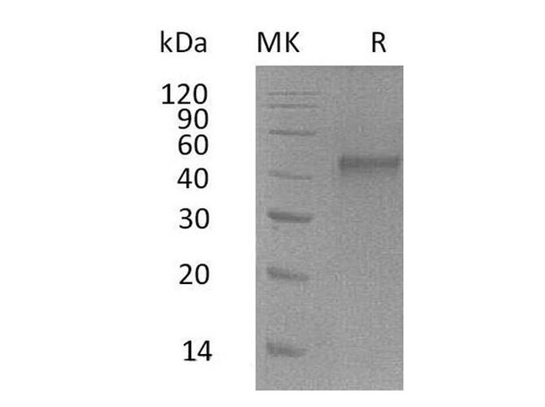 Mouse ST6GALNAC2 Recombinant Protein (RPES2219)