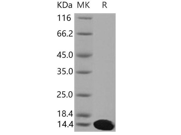 Mouse S100A5 Recombinant Protein (His Tag) (RPES2246)