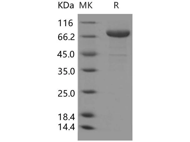 Transferrin Receptor/TFRC Recombinant Protein (RPES2247)