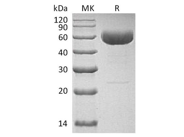 IL-22 Recombinant Protein (C-hIgG4 Fc) (RPES2250)