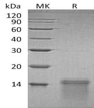 Human UCMA Recombinant Protein (RPES2252)