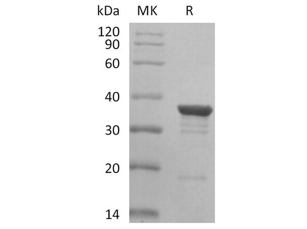 Human AKR1C2 Recombinant Protein (RPES2268)