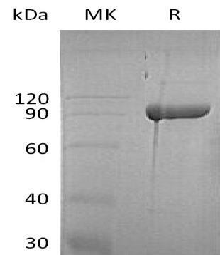 Human Diamine Oxidase/AOC1 Recombinant Protein (RPES2288)