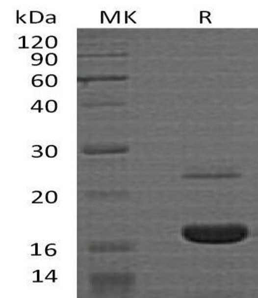 Human MYDGF Recombinant Protein (RPES2289)
