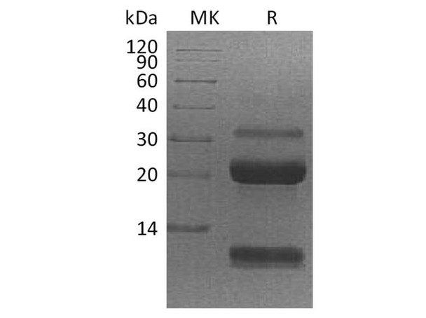 Human Kallikrein 6/KLK6 Recombinant Protein (RPES2297)