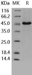 Human CD4/LEU3 Recombinant Protein (His Tag) (Active) (RPES2321)