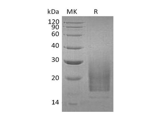 Human Interleukin-3/IL-3 Recombinant Protein (RPES2331)