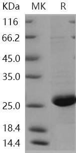 Human CRP/C-Reactive Recombinant Protein (RPES2367)