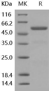 Human Carboxypeptidase E/CPE Recombinant Protein (RPES2369)