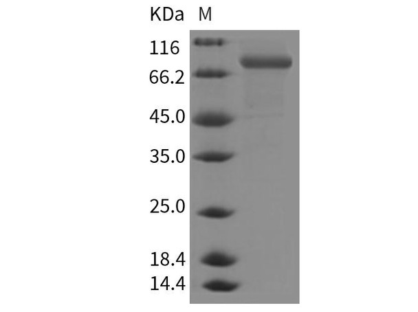 Mouse CHST5/GST4 Recombinant Protein (Fc Tag) (RPES2370)