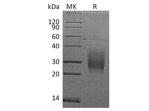 Mouse TRAIL R2/TNFRSF10B Recombinant Protein (RPES2387)