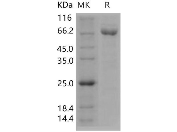 Human A2M/CPAMD5/Alpha-2-macroglobulin Recombinant Protein (His Tag) (Active) (RPES2417)