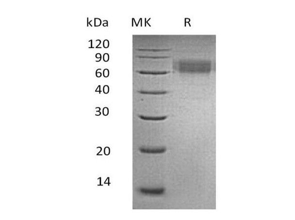 Human Ameloblastin/AMBN Recombinant Protein (RPES2418)