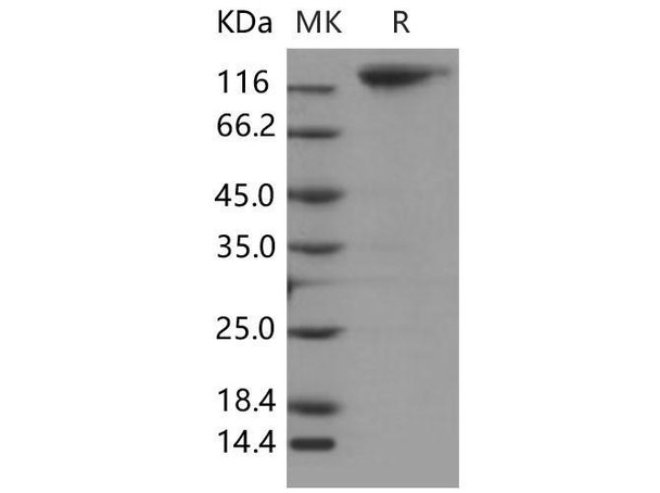 Mouse MERTK/MER Recombinant Protein (RPES2423)